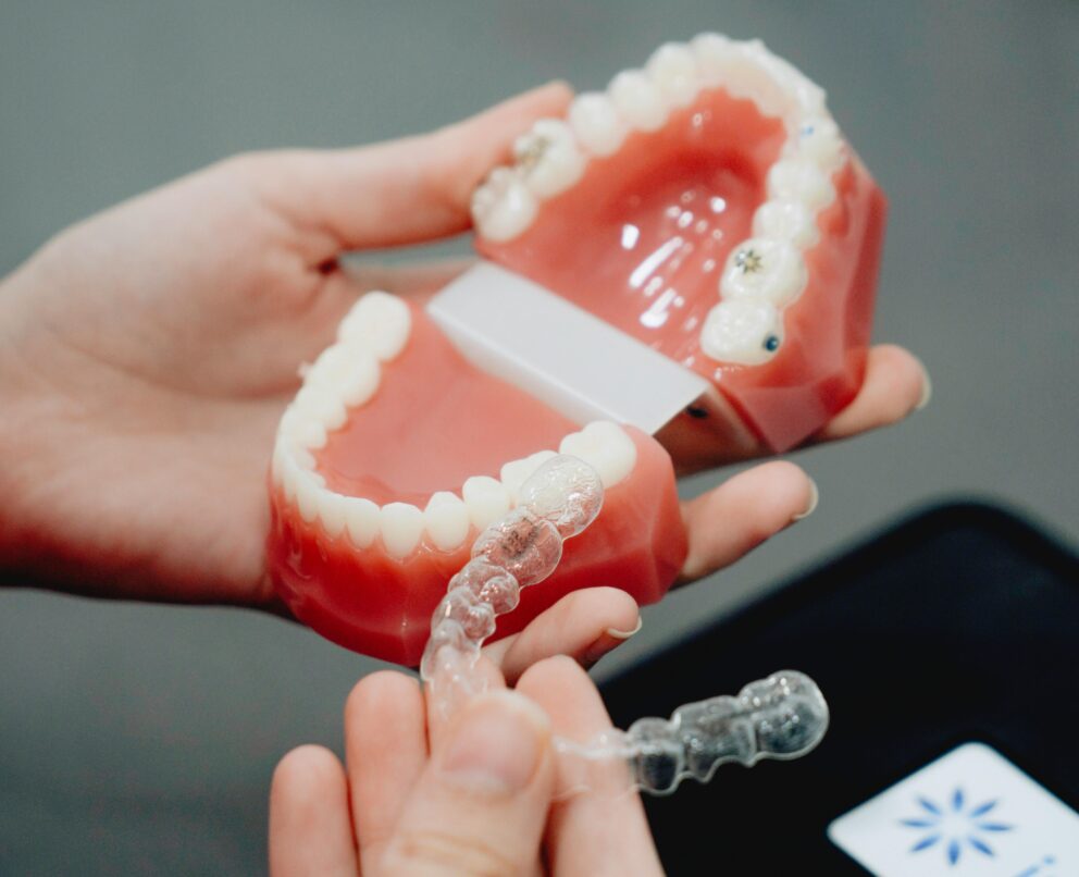 hands holding model of human teeth and an Invisalign near me tray